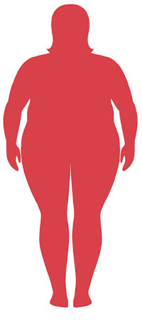 شاخصه توده بدنی چاق مفرط